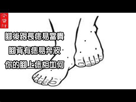 腳心凹|非富即貴！5種腳相註定好命 痣長在這裡「天生帝王命。